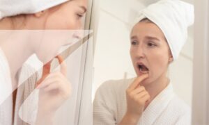 Find a solution to your bleeding gums.