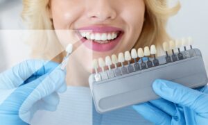 Professional tooth whitening can help.