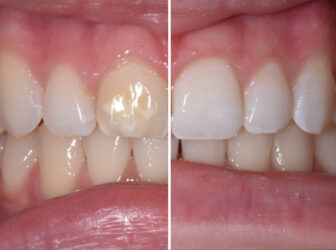 patient before after