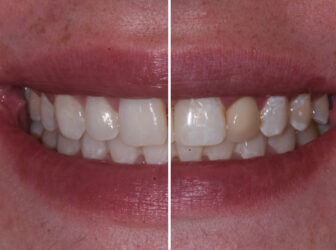 patient before after