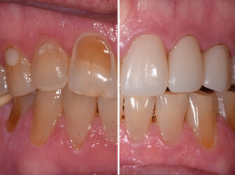 patient before after