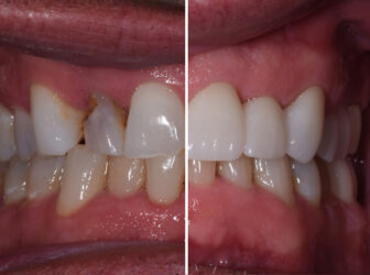 patient before after