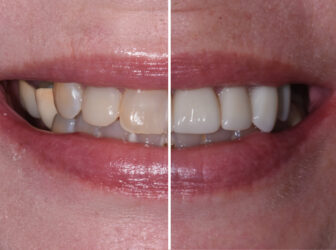 patient before after