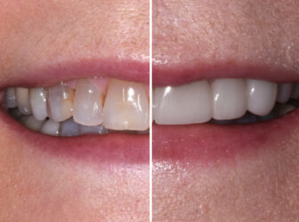 patient before after