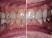 patient before after