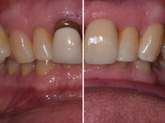 patient before after